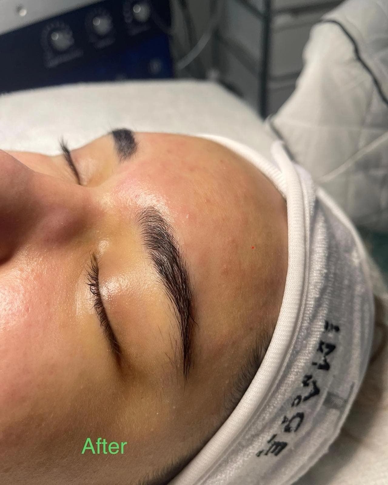 Facial & Peeling with PRX T33